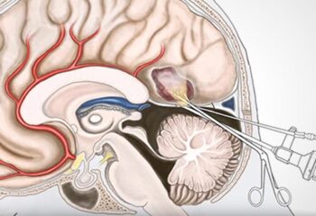 Brain & Spinal Surgery